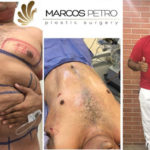 El “antes” y el “después” de Rolando Ochoa tras su cambio extremo